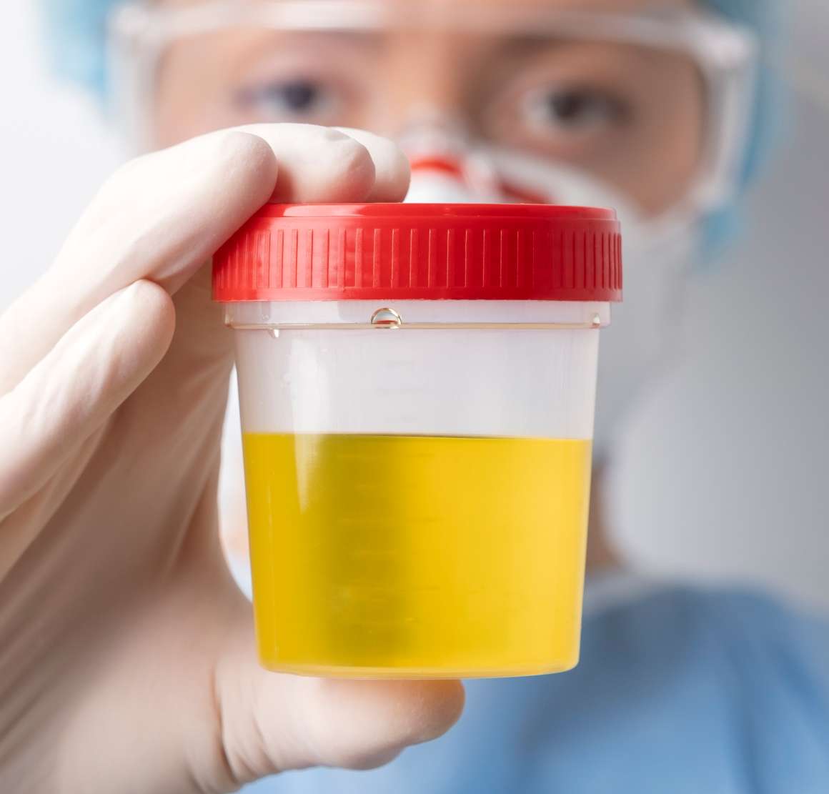 Hoe lang is CBD detecteerbaar in urine?