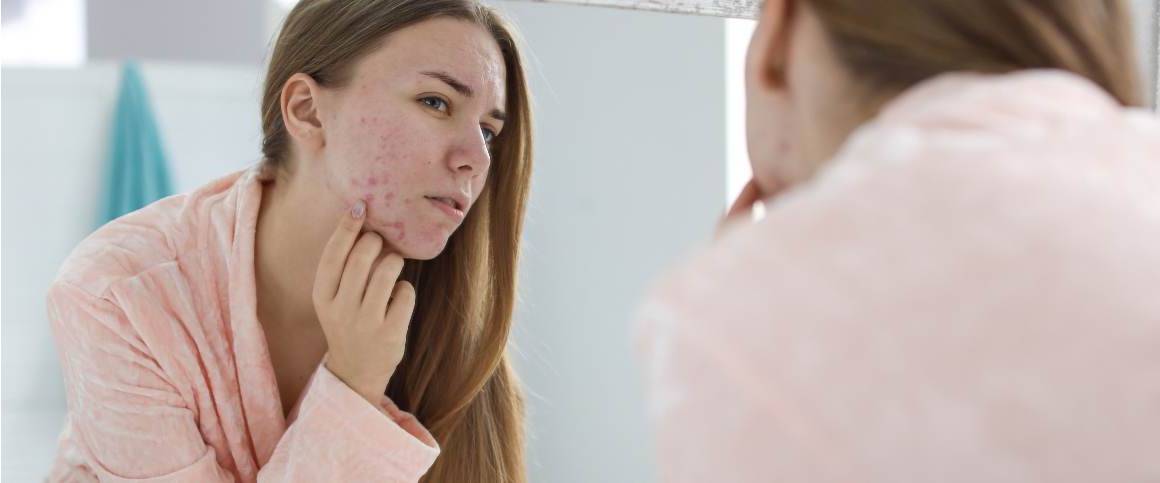 De 10 beste vruchten die acne helpen verwijderen